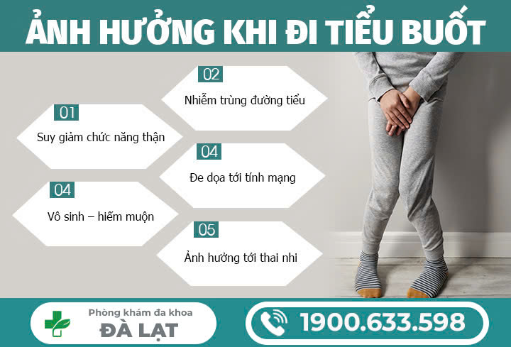 Hình ảnh minh họa
